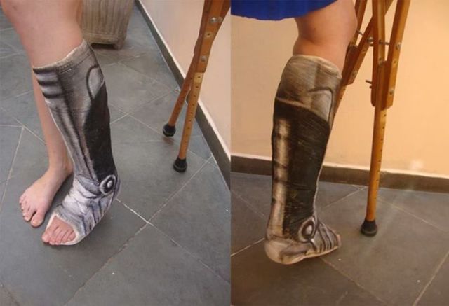 IRTI - funny picture #6265 - tags: broken leg plaster cast robocop.