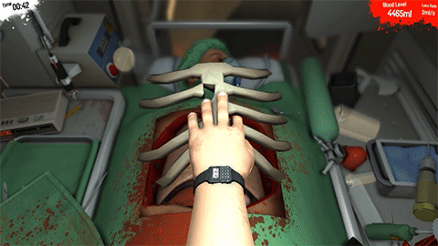 IRTI - funny GIF #4934 - tags: surgeon simulator your free now rib cage  ambulance door